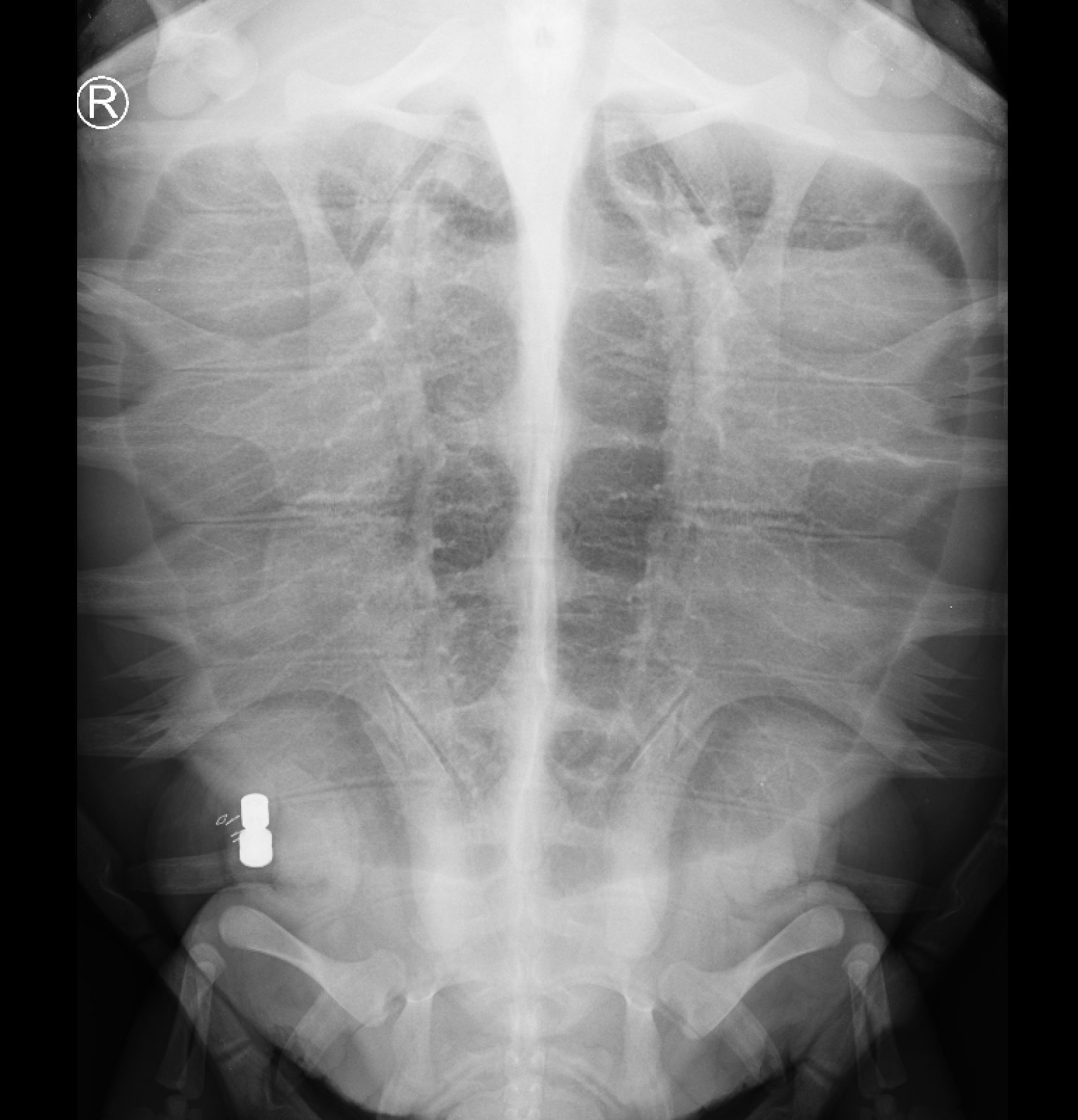 An X-ray of a sea turtle with an implanted acoustic tag.